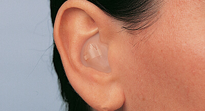 Concha-Hörgerät im Ohr